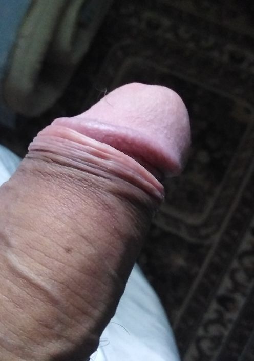 Комент