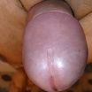 122