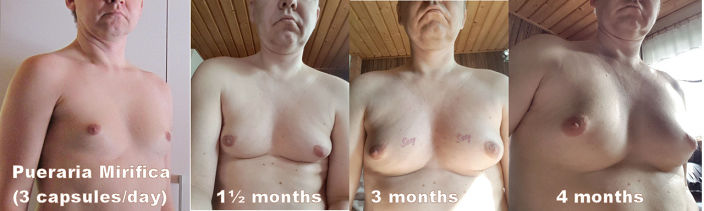 Sissy grow boobs in 4 months