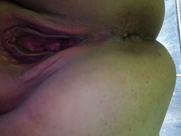 После подготовки анала