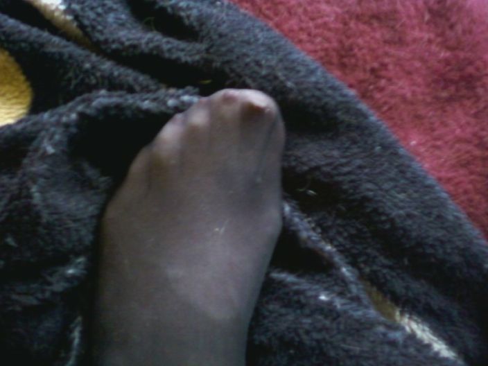 my toes in hose