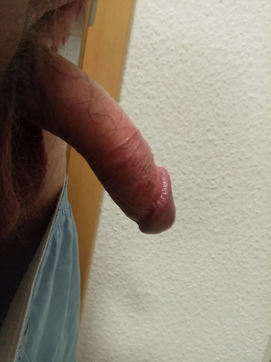 Член2