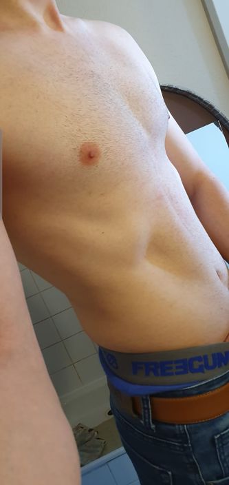 Moi