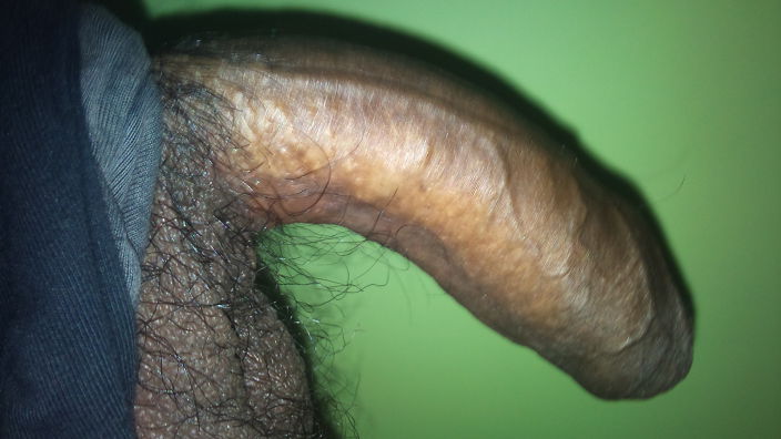 My dick