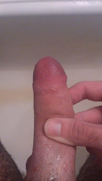 ......................