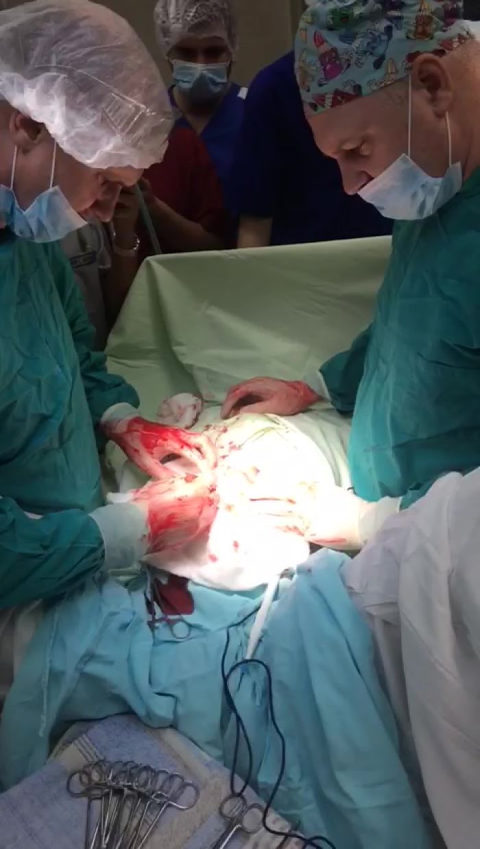 гамасеку неповезло