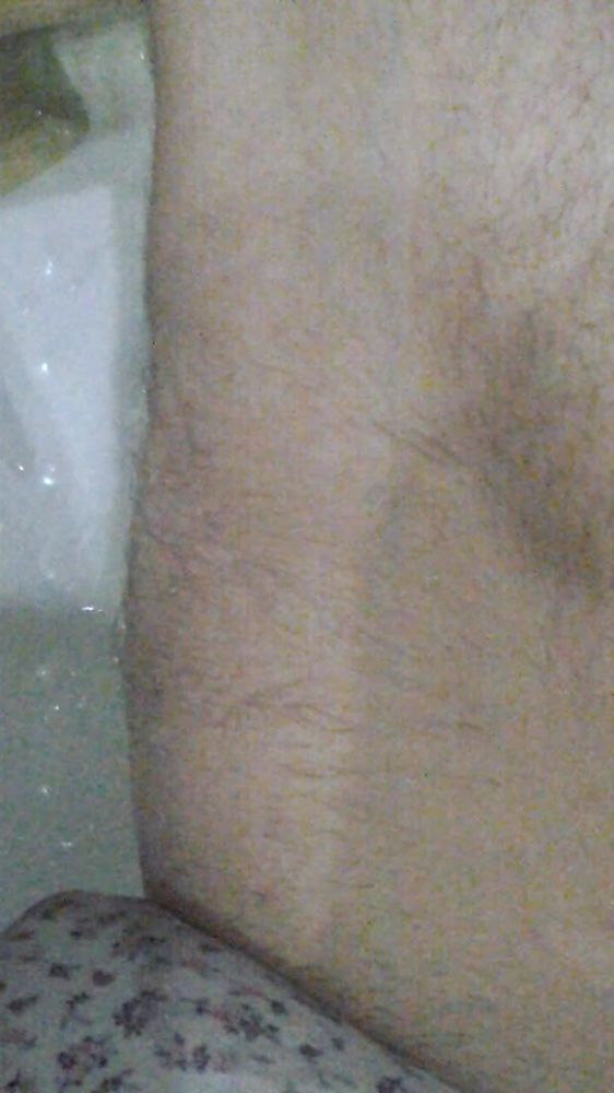 Пісь пісінг